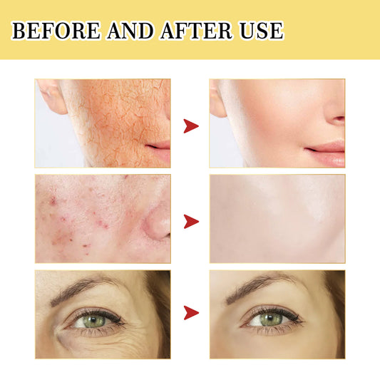 Original Snail Serum: Collagen Facial Treatment